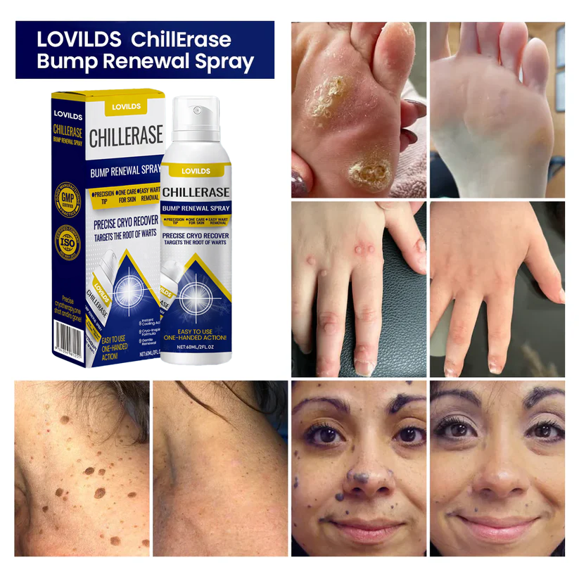 LOVILDS™ ChillErase Bump Renewal Spray🔥