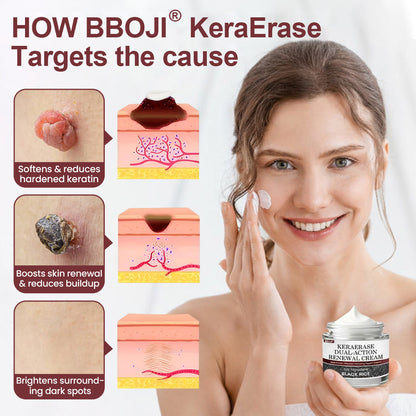 BBOJI® KeraErase Dual-Action Renewal Cream